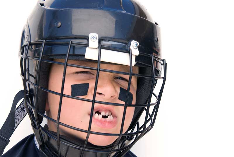 Primer plano de un joven jugador de hockey con casco oscuro y protección facial, al que le faltan dientes frontales y rayas negras en las mejillas, formando un rostro expresivo. Perfecto para entender el comportamiento infantil o discutir soluciones de crianza relacionadas con el espíritu deportivo.